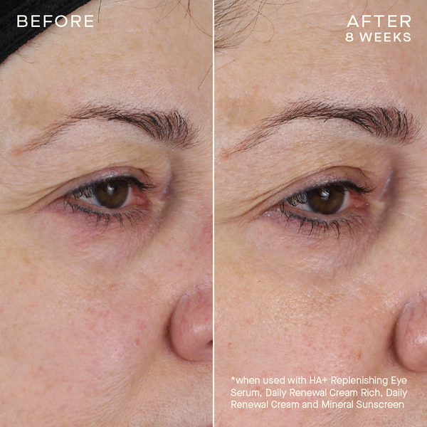 Ourself HA+ REPLENISHING EYE SERUM with Subtopical Firming Technology™